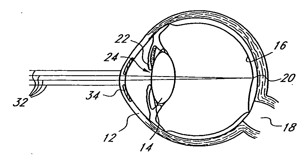 Visual for this record: Ives patented a slotted screen that split a photo per eye
